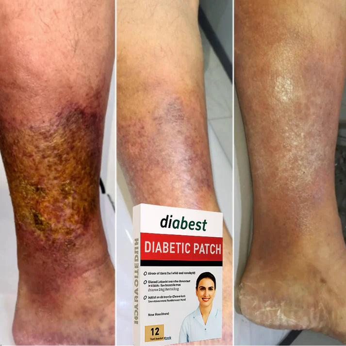 Parches Reguladores de azúcar🩸💪 Diabetes y Resistencia a la insulina