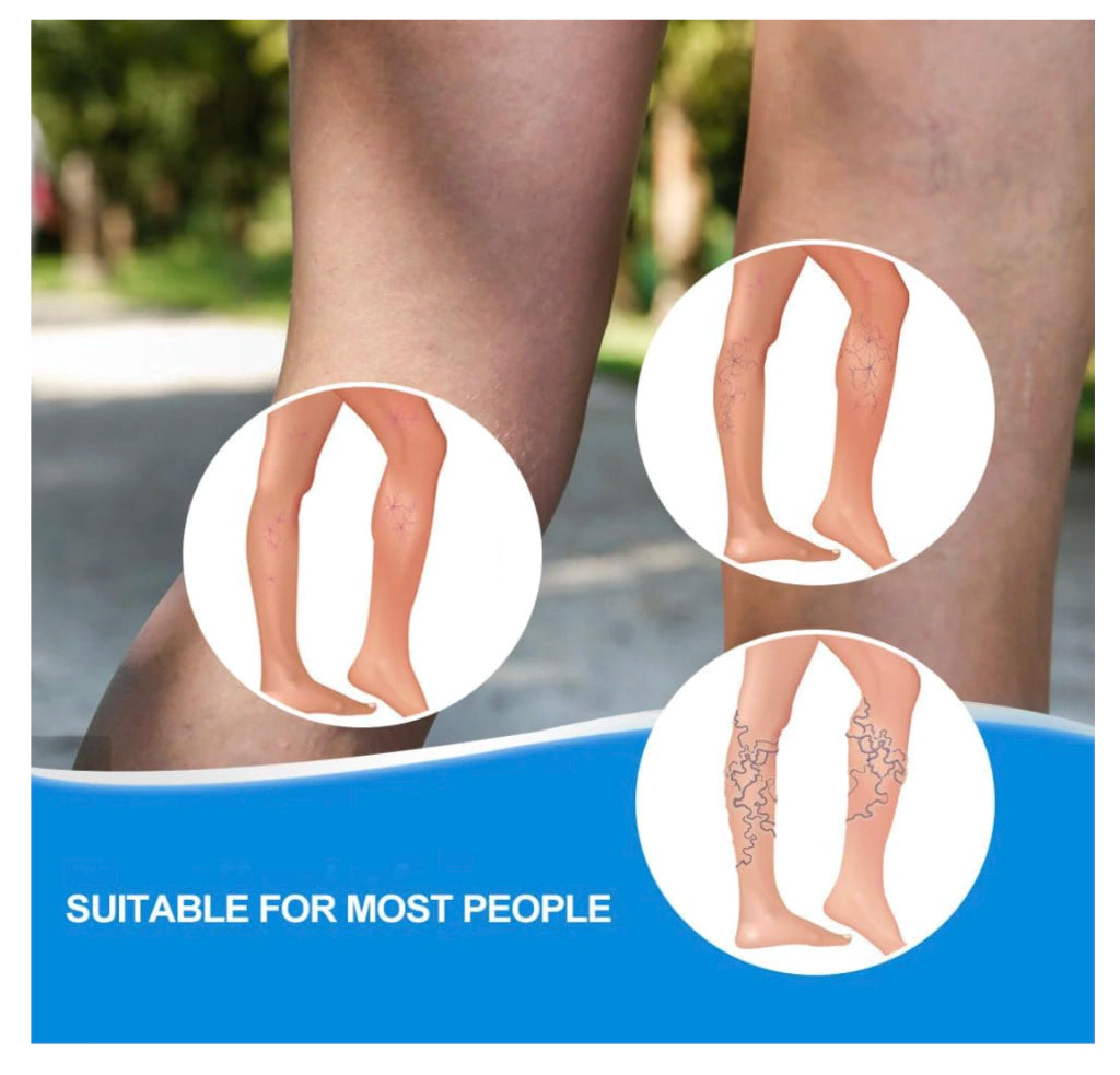 Crema Para Varices Piernas Perfectas Salud Mejora Apariencia