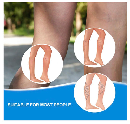 Crema Para Varices Piernas Perfectas Salud Mejora Apariencia