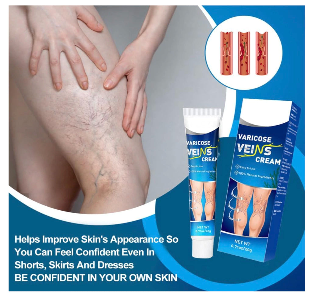 Crema Para Varices Piernas Perfectas Salud Mejora Apariencia