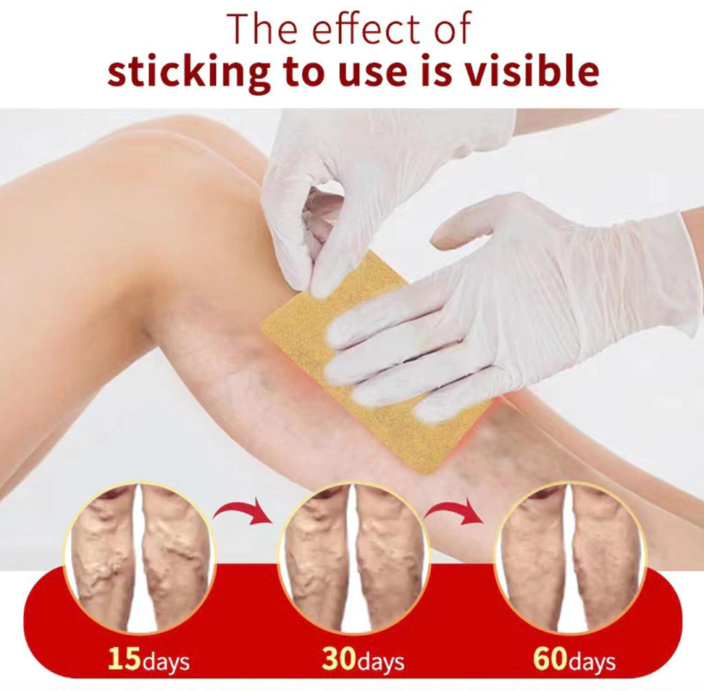 Parches Para Venas Varices x6 Mejora Aparencia y Salud De Tus Venas