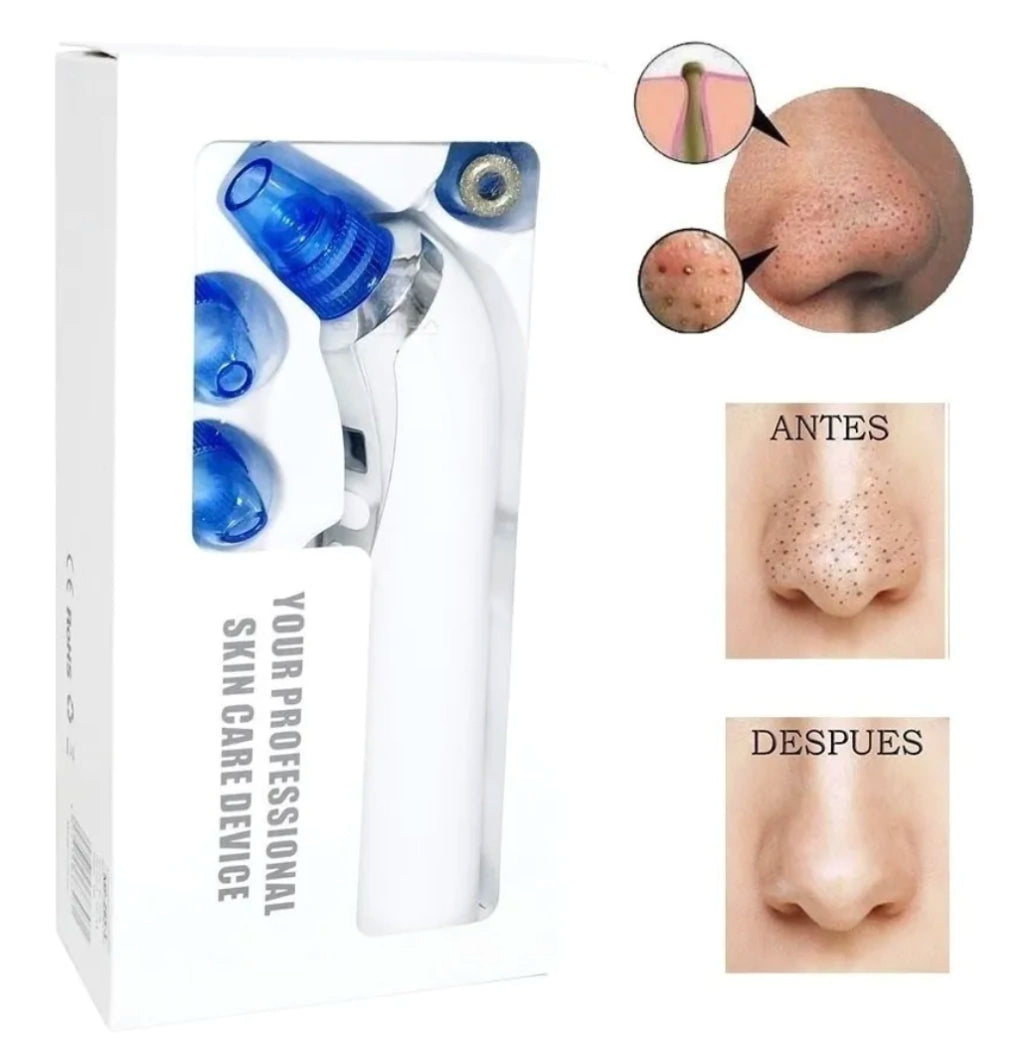 Removedor de Espinillas y Puntos Negros Recargable Pantalla Led