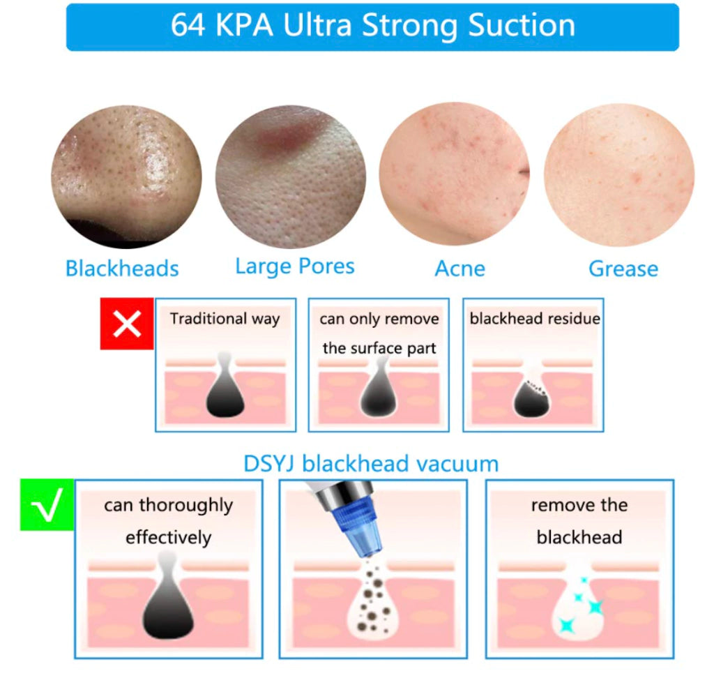 Removedor de Espinillas y Puntos Negros Recargable Pantalla Led